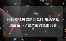 用药水祛斑效果怎么样 用药水祛斑后留下了很严重的色素沉着