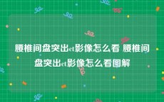 腰椎间盘突出ct影像怎么看 腰椎间盘突出ct影像怎么看图解