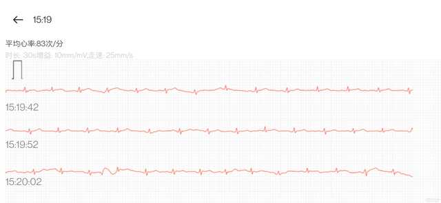 把你的心交给它吧！OPPO Watch 2 ECG版上手体验